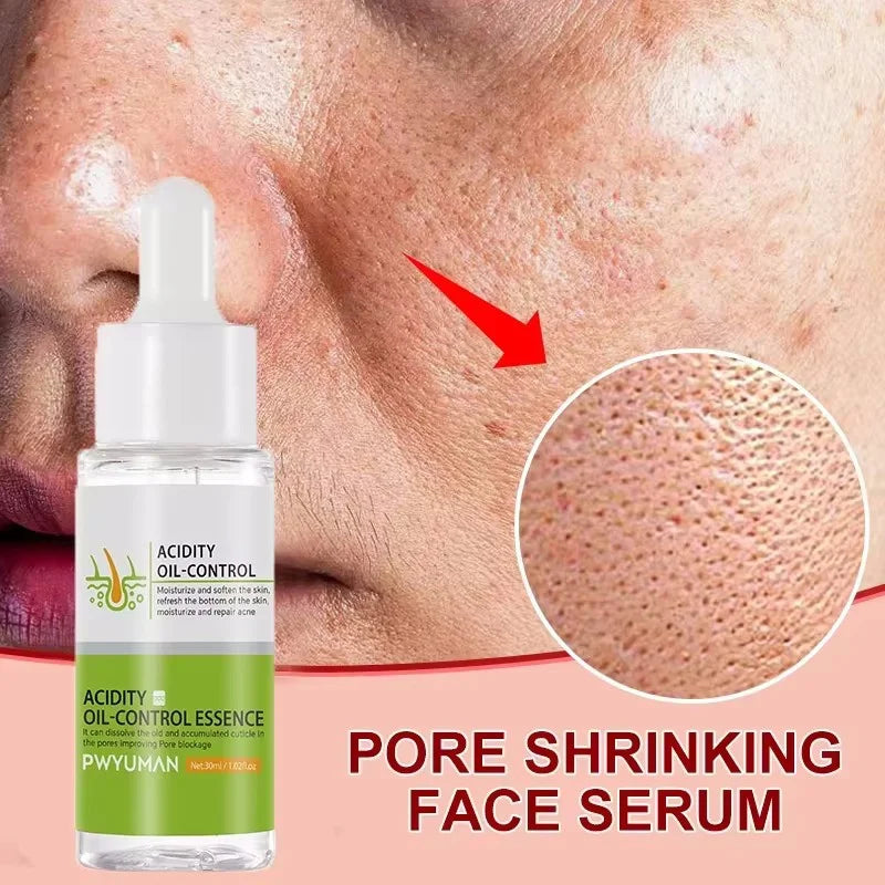 Sérum Pores & Acné
