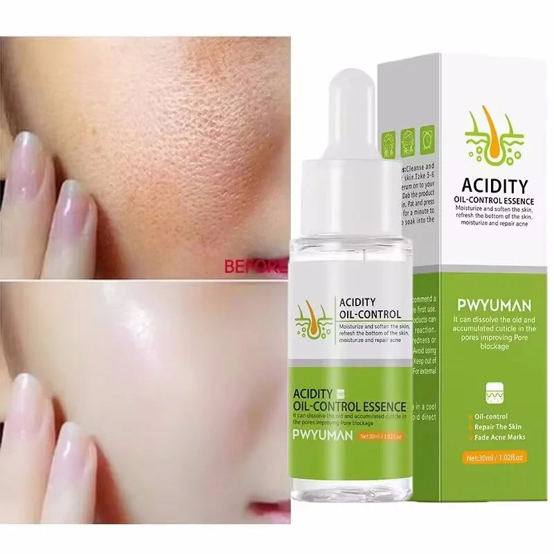Sérum Pores & Acné